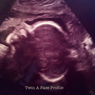 Twin/Pregnancy Update-31 Weeks!